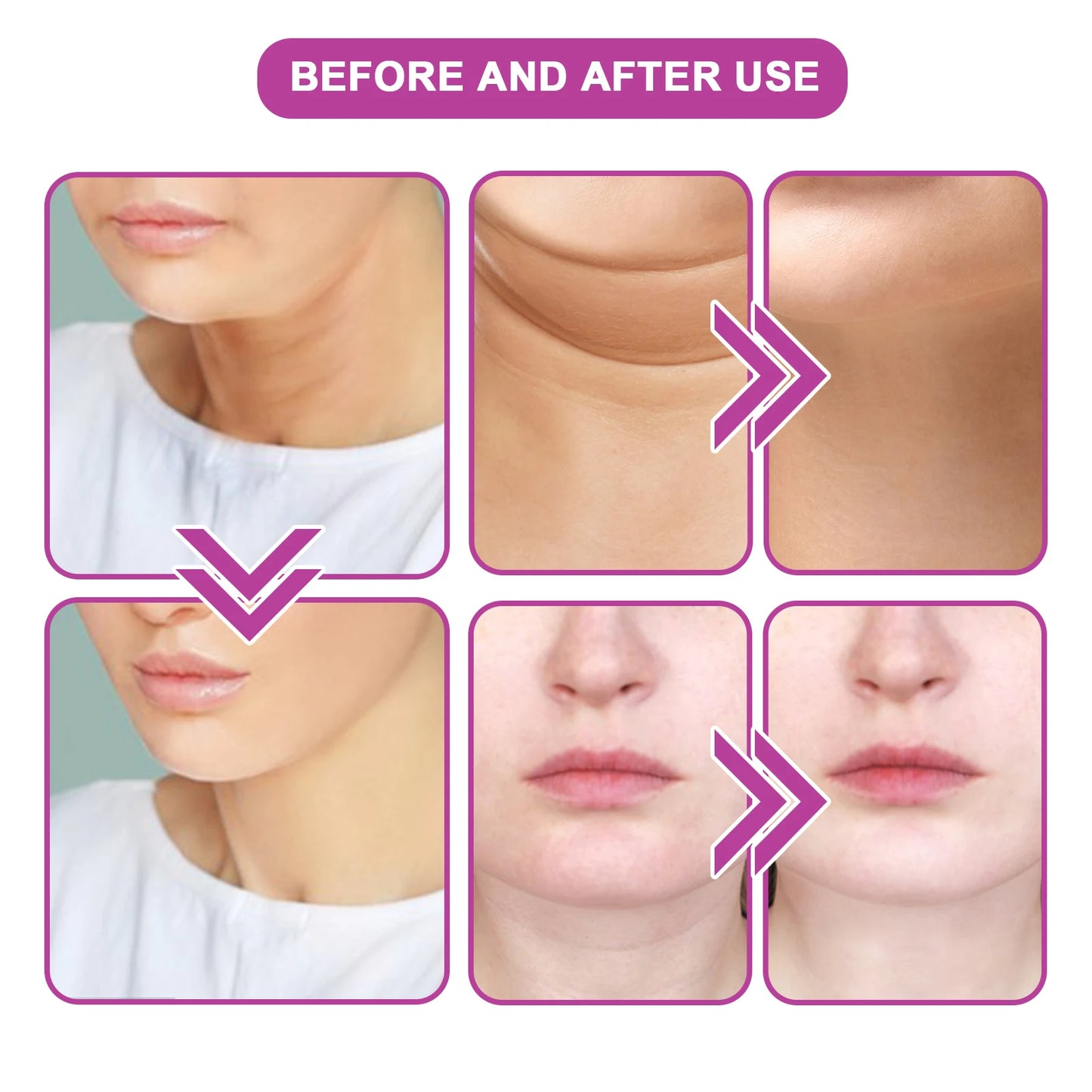 Neck Tightening Cream Reduce Neck Wrinkles